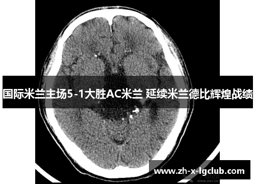 国际米兰主场5-1大胜AC米兰 延续米兰德比辉煌战绩
